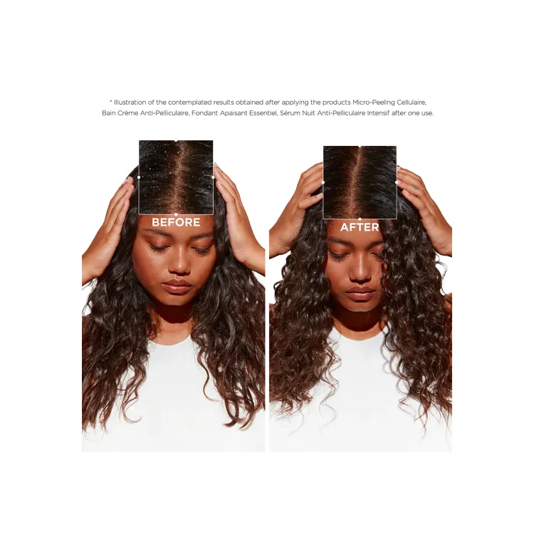 KÉRASTASE SYMBIOSE BAIN CREME ANTI-PELLICULAIRE | ANTI-DANDRUFF SHAMPOO FOR DRY SCALP - Shampoo